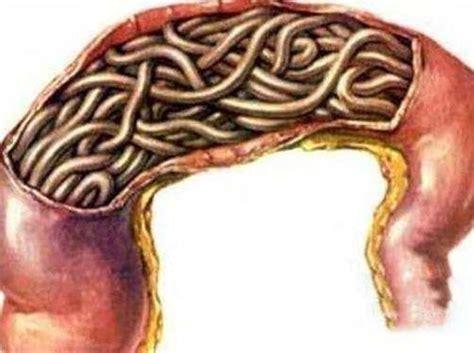 内部寄生虫最新版本更新：有哪些新内容值得期待