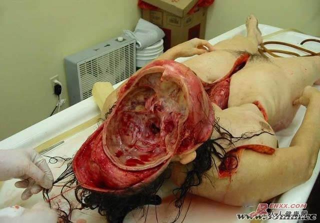 寻找屍安卓汉化资源?这里有你想要的!